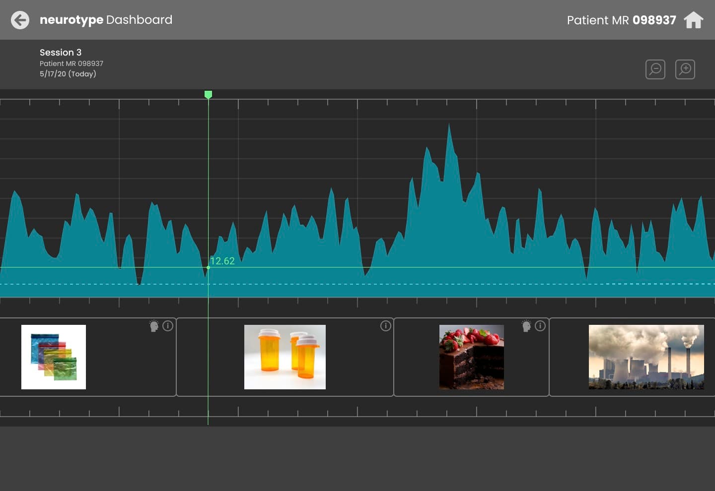 Screenshot of the NeuromarkR EEG-based assessment platform dashboard